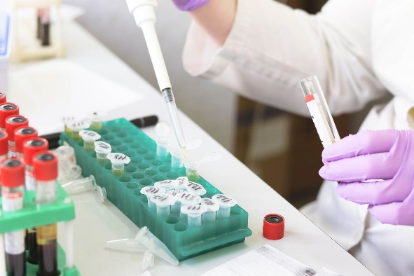 Tes darah di laboratorium kimia – kompas.com/Silmi Nurul Utami